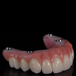 Hybrid Prosthesis